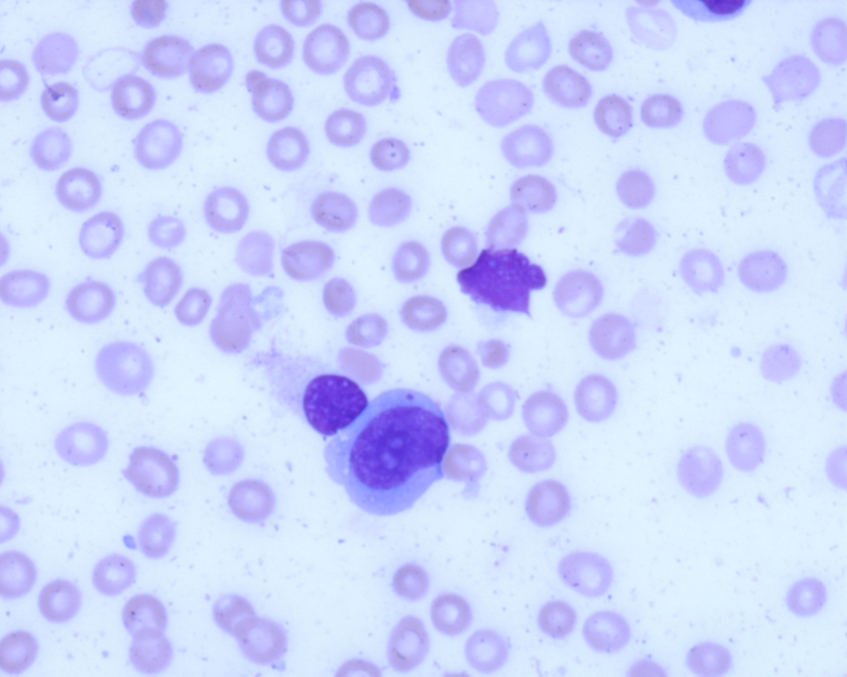 direct smear 60X blast